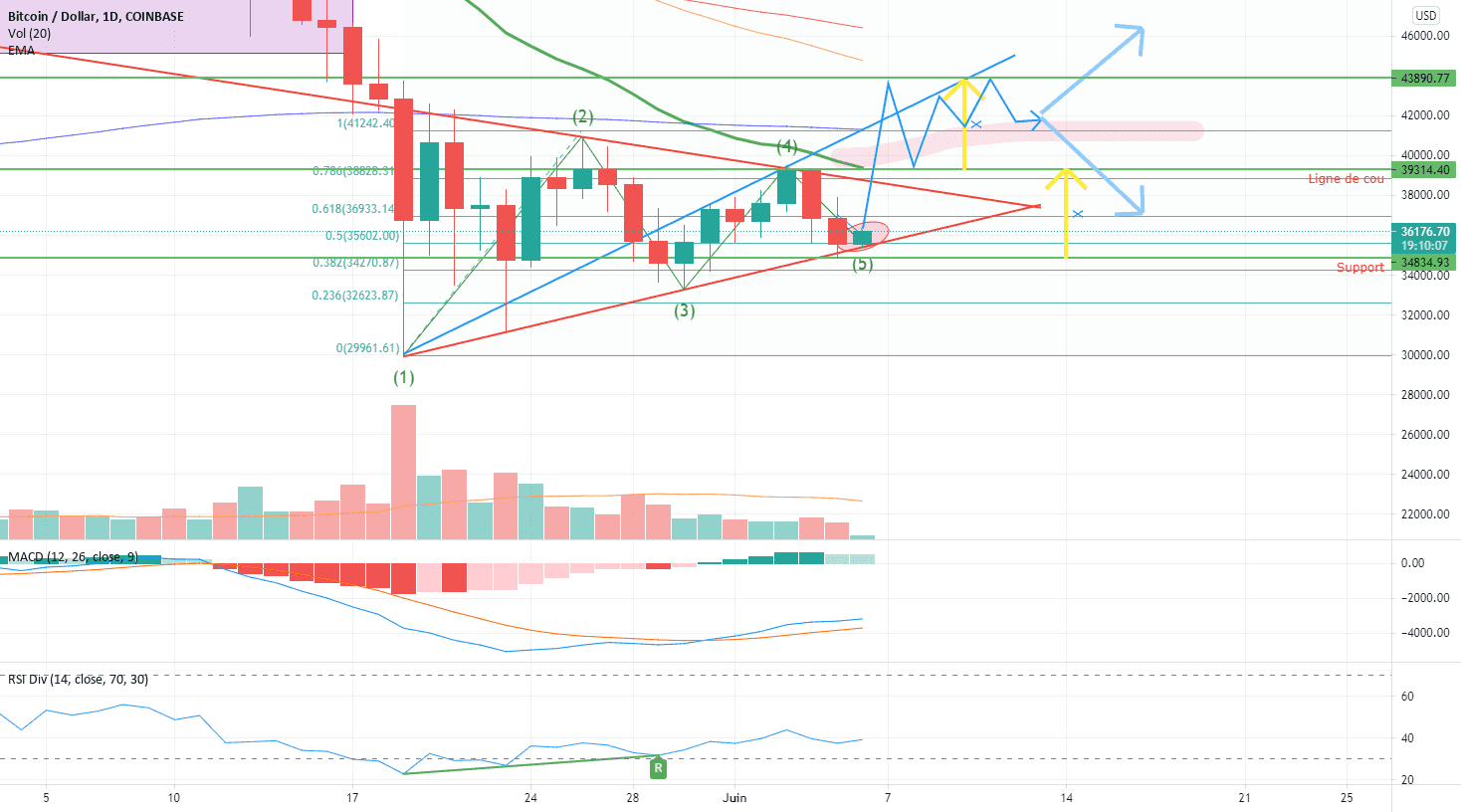 BTC/USD La clôture Daily parfaite a court terme. pour COINBASE:BTCUSD par dodolasomure